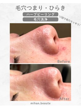 ミハン ボーテ(mihan.beaute)/