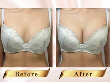 エクラパピヨン 荻窪(Eclatpapillon)の雰囲気（やわらかいふわふわバスト/育乳）