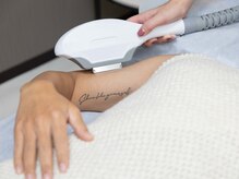 リルの雰囲気(脱毛卒業を目指します。)