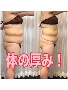 ボディエステティック アクアオーラ 富山店/厚みが違う！