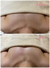 シトロン(citron)/バストケア