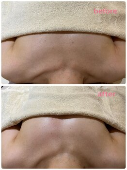 シトロン(citron)/バストケア