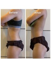 サロン ド クロエ(salon de Chloe)/Before→Afteｒ(初回体験)