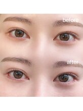 エクラ バイ シャンリィ(eclat by shanLy)/透明感