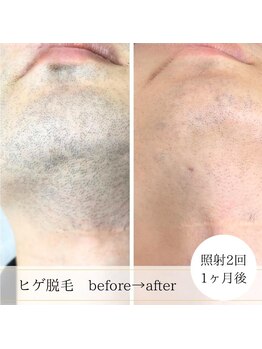 ココスターリー 筑紫野店(Coco starry)/刺激に弱い方は調整出来ますよ♪