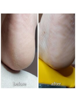 爪切り屋 足楽/