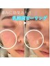 小顔＆引き締め効果抜群!!【高濃度乳酸ピーリング】白玉ホワイトスノーピール
