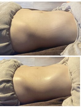 ヴァローレ(valore)/お腹の張り撃退