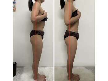 シャルム(Charme)/メディセル×骨盤