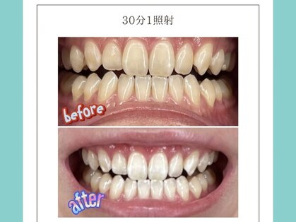 ミモアサロン 岡崎店(mimoaサロン)の写真