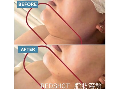 スリーアイ 天王寺店(3EYE)の写真