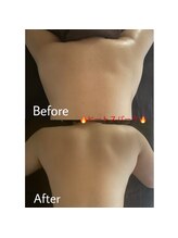 ベル 長崎(Belle)/ビフォーアフター