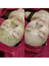 マイフェアレディ 今池(MyFairLady)/毛穴洗浄&ハーブピーリング艶肌