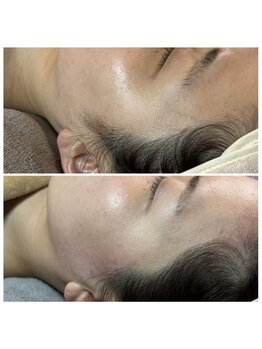 ワクシングアンドビューティーワイ(Waxing&Beauty_Y)/ワックス脱毛～もみあげ～