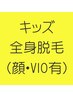 【キッズ脱毛】中学生までOK★　まるっとキッズ全身脱毛　1回 80分　¥7,200