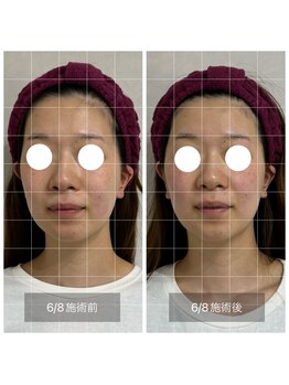 ファミーユ(famille)/小顔頭蓋骨骨盤矯正 B/A