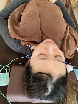 ハリファ鍼灸院 横浜関内院(HariFa鍼灸院)/美容施術