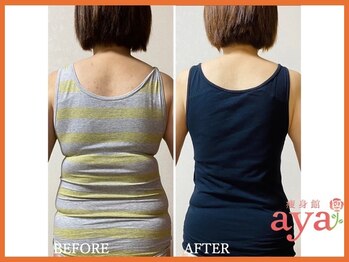 痩身館アヤ(aya)/耳つぼダイエット【富山/痩身】