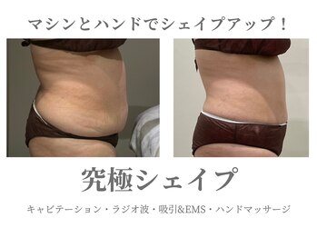 エクラ イオンモール徳島店(ECLAT)/究極シェイプ