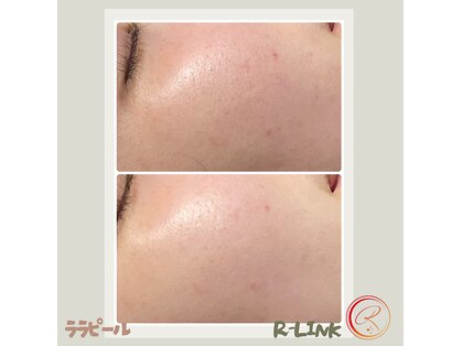 アールリンク(R-Link)の写真