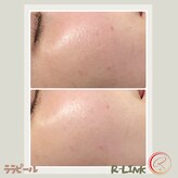 アールリンク(R-Link)