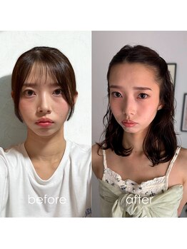 ロロサロン(roro salon)/トータル診断【before＆after】