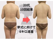 ビーフォー(be for)/挙式に向けて♪