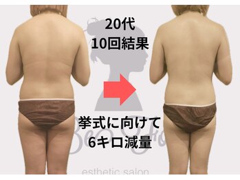 ビーフォー(be for)/挙式に向けて♪