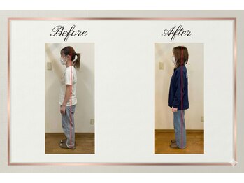 からだととのう ナチュラプレミアム アカサカ(Natura premier akasaka)/劇的変化/姿勢・小顔革命