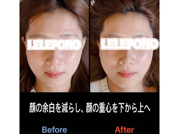 美容矯正サロン レレポノ(LELEPONO)/