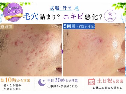 おうちサロン ミキの写真