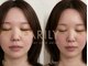 アリリィ(ARILY)の写真/最新インディバ機器を使用!インディバスペシャリスト集団が自信の持てるフェイスラインに導きます。
