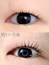 アイマイミー(i my me.)/約1ヶ月の美容液の効果