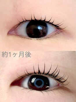 アイマイミー(i my me.)/約1ヶ月の美容液の効果