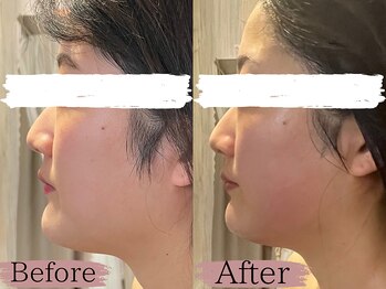 サロン ジジ(salon JiJi)/韓国コルギ