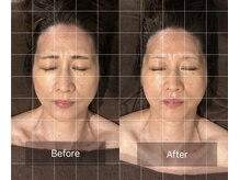 グレースフィオーレ 京橋店(gracefiore)/Before/After（ 1回施術）