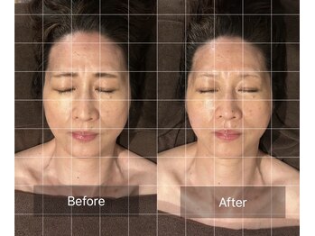 グレースフィオーレ 京橋店(gracefiore)/Before/After( 1回施術)