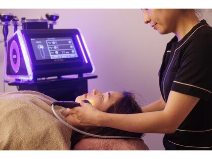 ベレピ(belepi)の写真