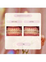 プラスビーセルフ(+b self)/ホワイトニングビフォーアフター