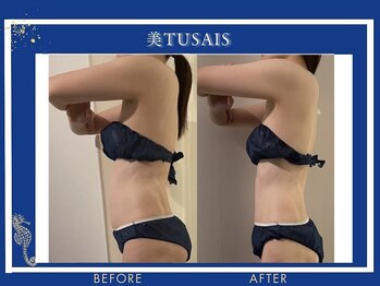 ビテュセ(美Tu sais)/【ダイエット・痩身】ボディケア