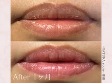 ナチュラルーム 那覇(NATURA room)/ローマピンク/リップ施術