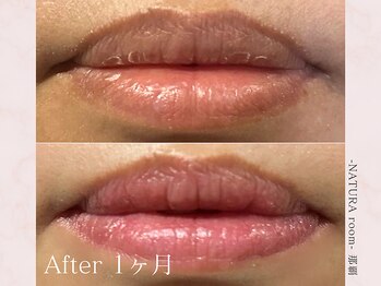 ナチュラルーム 那覇(NATURA room)/ローマピンク/リップ施術