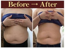 クオレ(CUORE)/ビフォーアフター