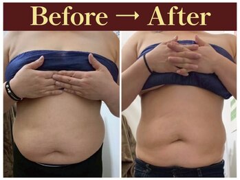 クオレ(CUORE)/ビフォーアフター