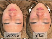 グランビューティ(Glanz Beauty)/20代男性