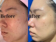 ヒール(heal)/症例