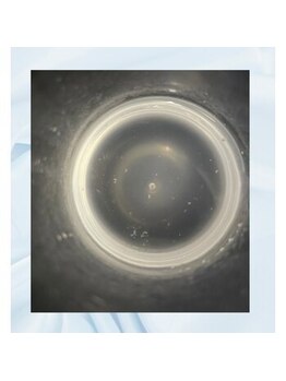 ファーファラ(Farfalla)/毛穴洗浄