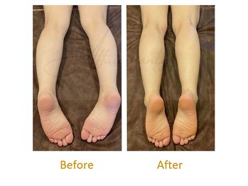 アッファシナンテ(Affascinante)/施術:オリジナル深筋骨メソッド