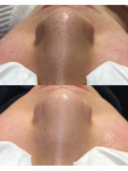 ルチル 八女店(Rutile)/肌を一度リセット！