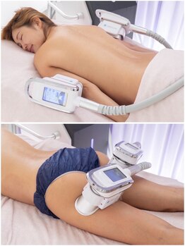 アクアモアの写真/全身セレクト痩身!360°冷却【脂肪冷却4ヶ所を一度に体験★¥6980】気になるパーツを速攻スリム♪リピ続出!